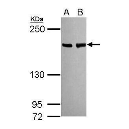 BLM Antibody from Signalway Antibody (35460) - Antibodies.com