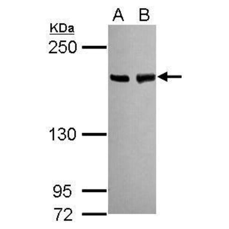 BLM Antibody from Signalway Antibody (35460) - Antibodies.com