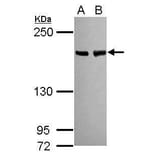 BLM Antibody from Signalway Antibody (35460) - Antibodies.com