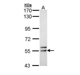 FRK Antibody from Signalway Antibody (35488) - Antibodies.com