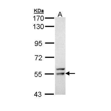 FRK Antibody from Signalway Antibody (35488) - Antibodies.com