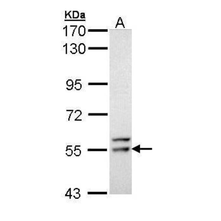FRK Antibody from Signalway Antibody (35488) - Antibodies.com