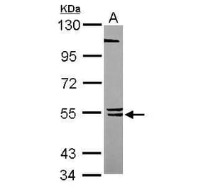 BLK Antibody from Signalway Antibody (35491) - Antibodies.com