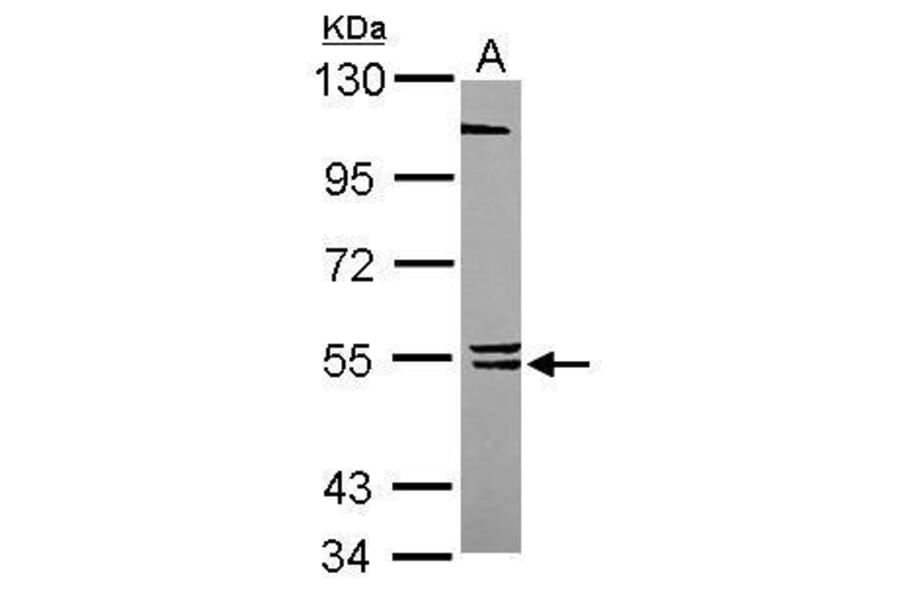 BLK Antibody from Signalway Antibody (35491) - Antibodies.com