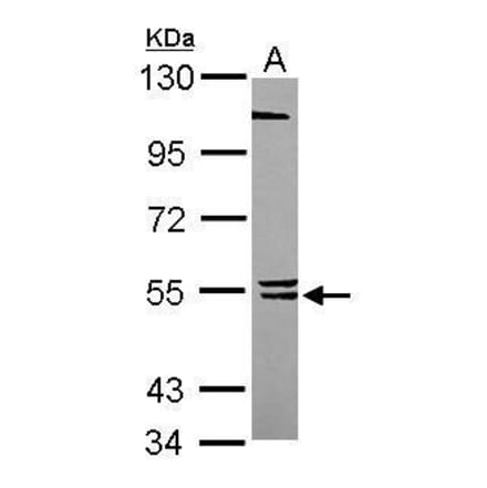 BLK Antibody from Signalway Antibody (35491) - Antibodies.com