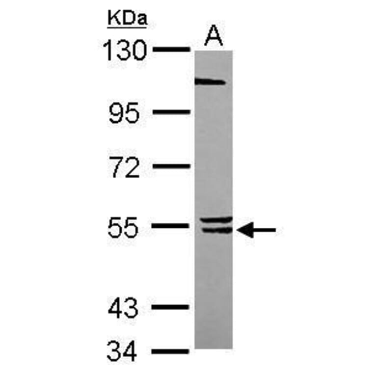 BLK Antibody from Signalway Antibody (35491) - Antibodies.com