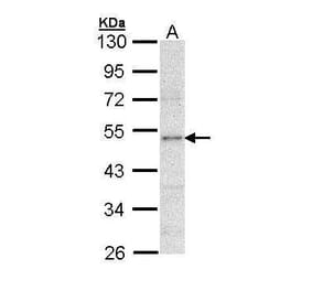 LPL Antibody from Signalway Antibody (35531) - Antibodies.com