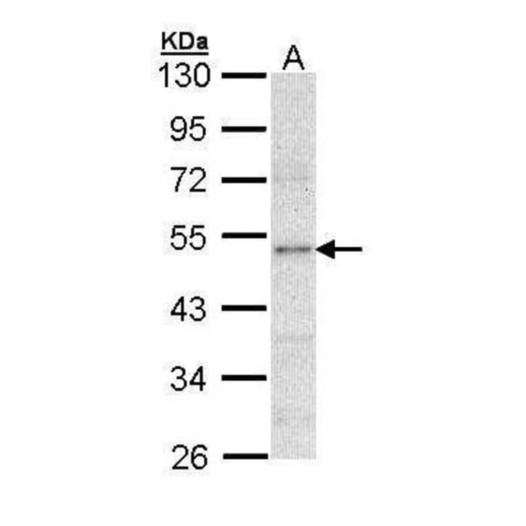 LPL Antibody from Signalway Antibody (35531) - Antibodies.com