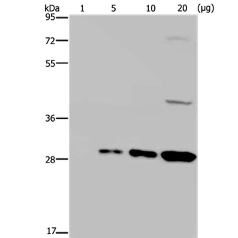 GFP Antibody from Signalway Antibody (35538) - Antibodies.com