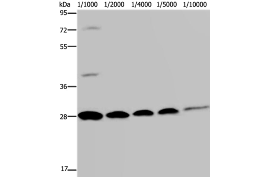 GFP Antibody from Signalway Antibody (35538) - Antibodies.com