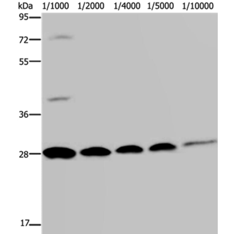 GFP Antibody from Signalway Antibody (35538) - Antibodies.com