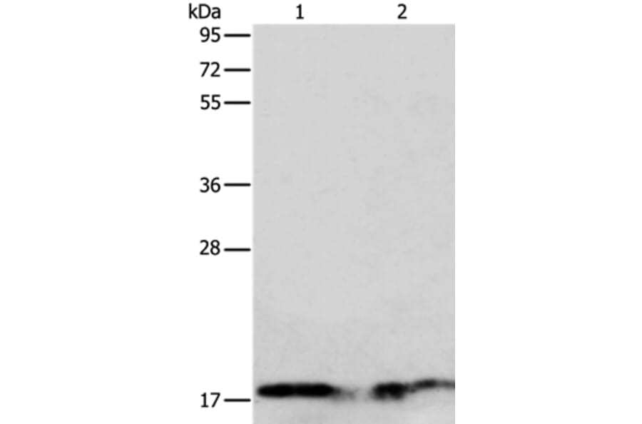 ANG Antibody from Signalway Antibody (35566) - Antibodies.com