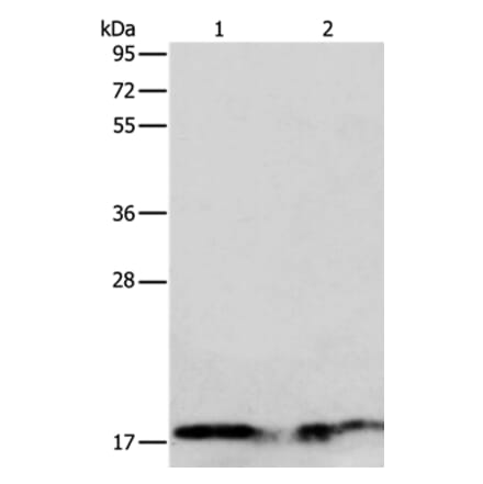 ANG Antibody from Signalway Antibody (35566) - Antibodies.com