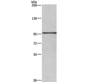 RB1 Antibody from Signalway Antibody (35851) - Antibodies.com