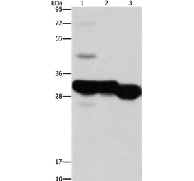 KHK Antibody from Signalway Antibody (36230) - Antibodies.com