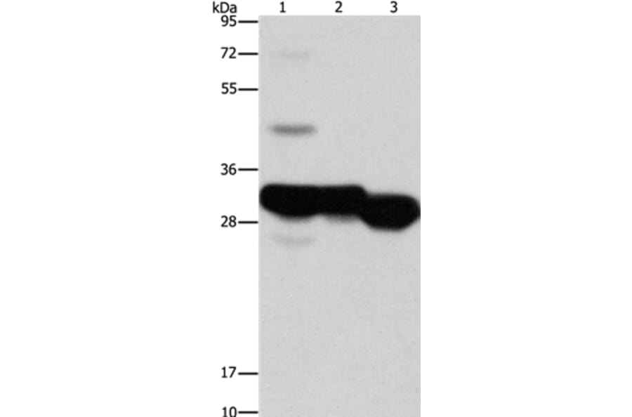 KHK Antibody from Signalway Antibody (36230) - Antibodies.com
