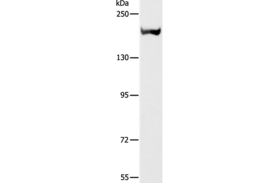 ACE Antibody from Signalway Antibody (36724) - Antibodies.com