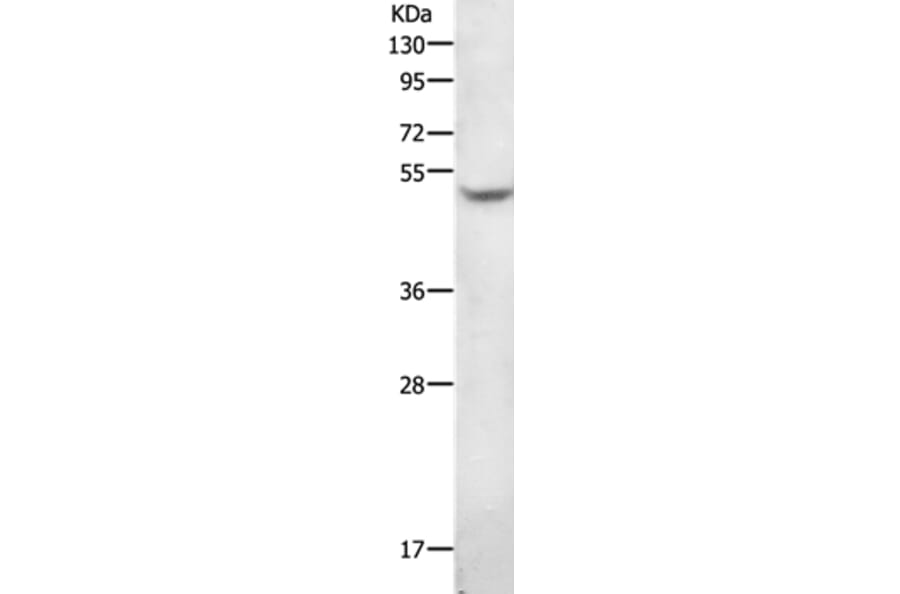 AGT Antibody from Signalway Antibody (36739) - Antibodies.com