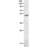 AGT Antibody from Signalway Antibody (36739) - Antibodies.com