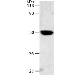 LOX Antibody from Signalway Antibody (36747) - Antibodies.com