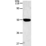 LOX Antibody from Signalway Antibody (36747) - Antibodies.com