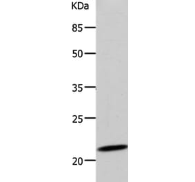 DUT Antibody from Signalway Antibody (36828) - Antibodies.com