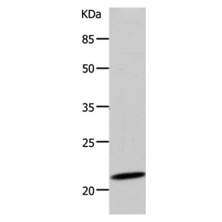 DUT Antibody from Signalway Antibody (36828) - Antibodies.com