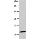 DUT Antibody from Signalway Antibody (36828) - Antibodies.com