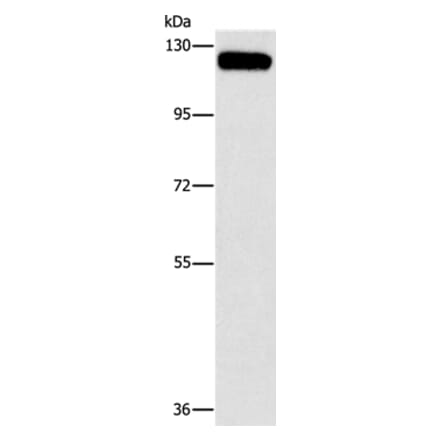 CBL Antibody from Signalway Antibody (37449) - Antibodies.com