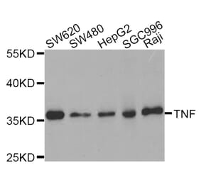 Western blot - TNF antibody from Signalway Antibody (38122) - Antibodies.com