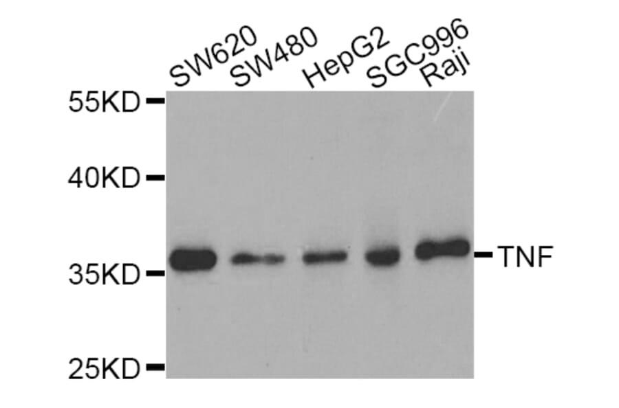 Western blot - TNF antibody from Signalway Antibody (38122) - Antibodies.com