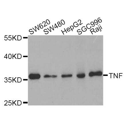 Western blot - TNF antibody from Signalway Antibody (38122) - Antibodies.com