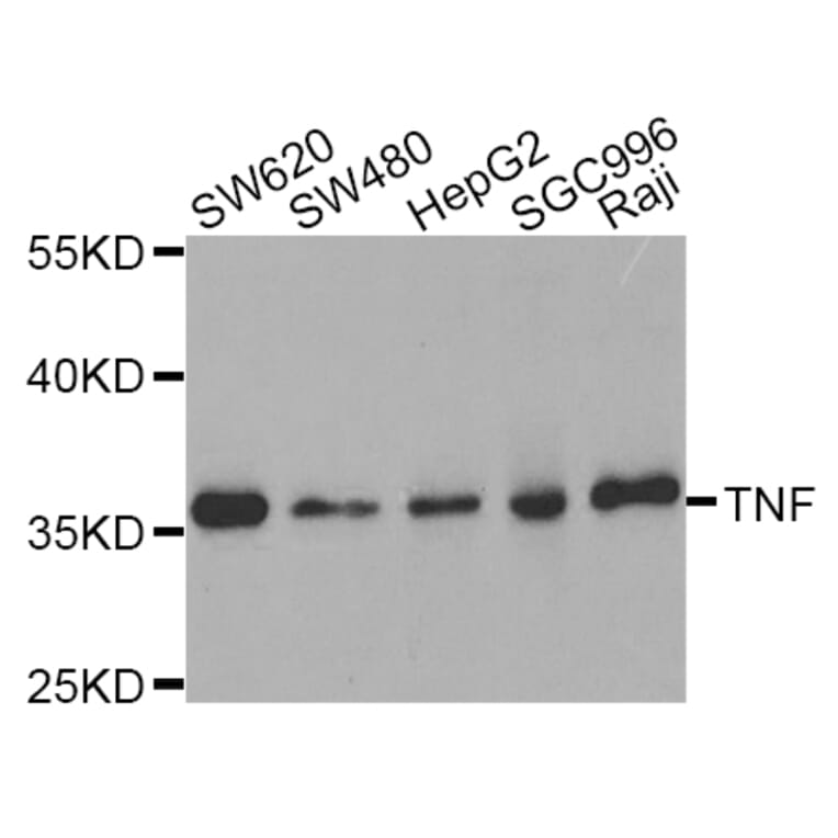 Western blot - TNF antibody from Signalway Antibody (38122) - Antibodies.com