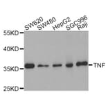 Western blot - TNF antibody from Signalway Antibody (38122) - Antibodies.com