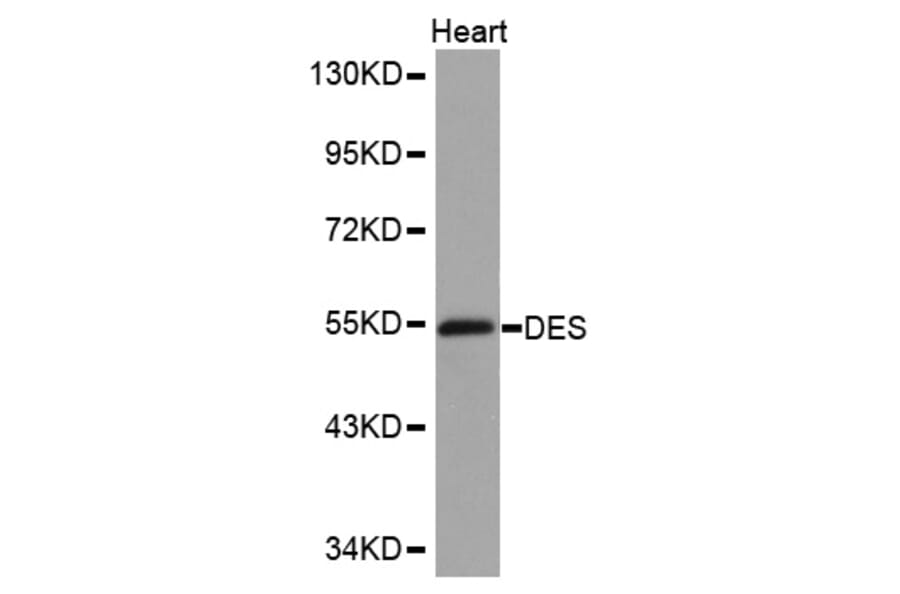 Western blot - DES antibody from Signalway Antibody (38152) - Antibodies.com