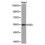 Western blot - DES antibody from Signalway Antibody (38152) - Antibodies.com