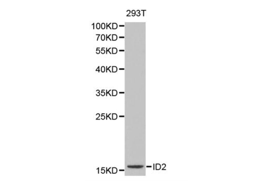 Western blot - ID2 antibody from Signalway Antibody (38164) - Antibodies.com