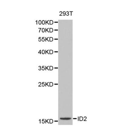 Western blot - ID2 antibody from Signalway Antibody (38164) - Antibodies.com