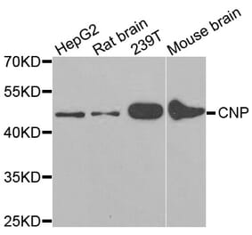 Western blot - CNP antibody from Signalway Antibody (38166) - Antibodies.com