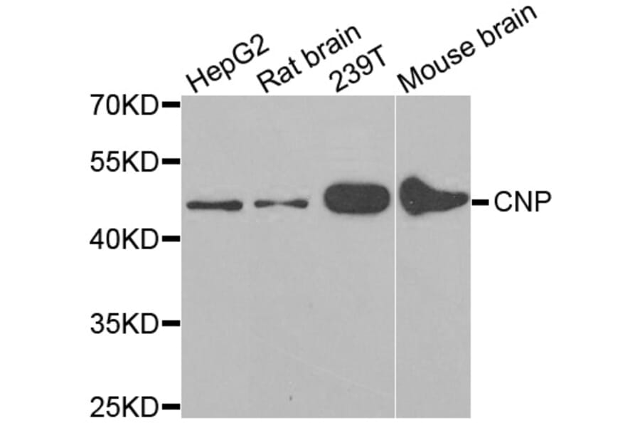 Western blot - CNP antibody from Signalway Antibody (38166) - Antibodies.com