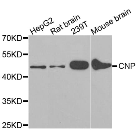 Western blot - CNP antibody from Signalway Antibody (38166) - Antibodies.com