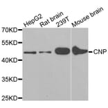 Western blot - CNP antibody from Signalway Antibody (38166) - Antibodies.com
