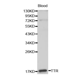 Western blot - TTR antibody from Signalway Antibody (38191) - Antibodies.com