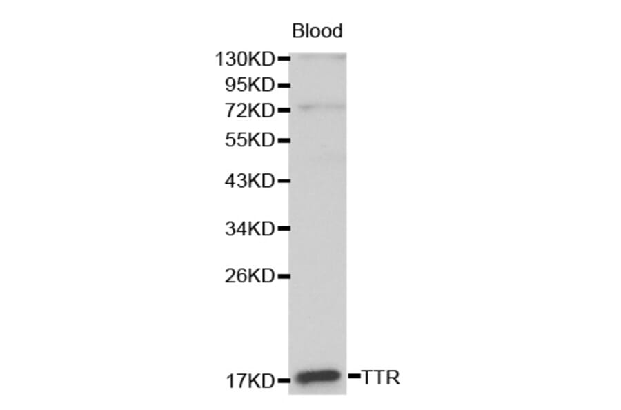 Western blot - TTR antibody from Signalway Antibody (38191) - Antibodies.com