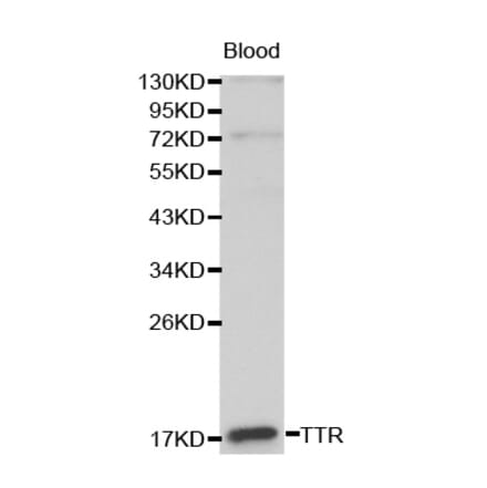 Western blot - TTR antibody from Signalway Antibody (38191) - Antibodies.com