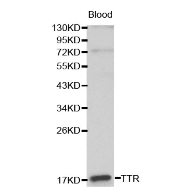 Western blot - TTR antibody from Signalway Antibody (38191) - Antibodies.com