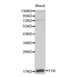 Western blot - TTR antibody from Signalway Antibody (38191) - Antibodies.com