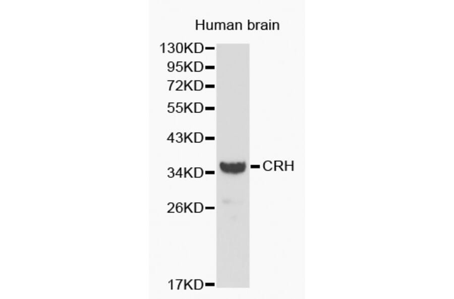 Western blot - CRH antibody from Signalway Antibody (38192) - Antibodies.com