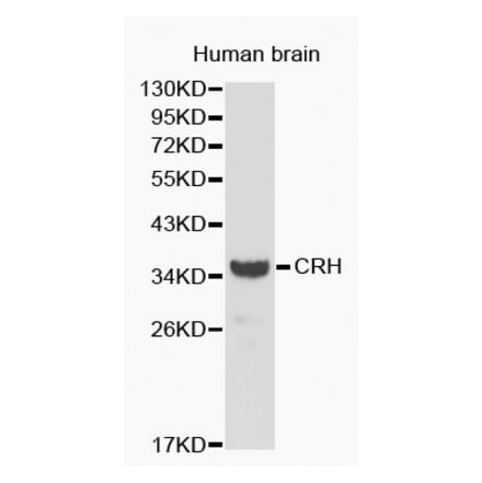 Western blot - CRH antibody from Signalway Antibody (38192) - Antibodies.com