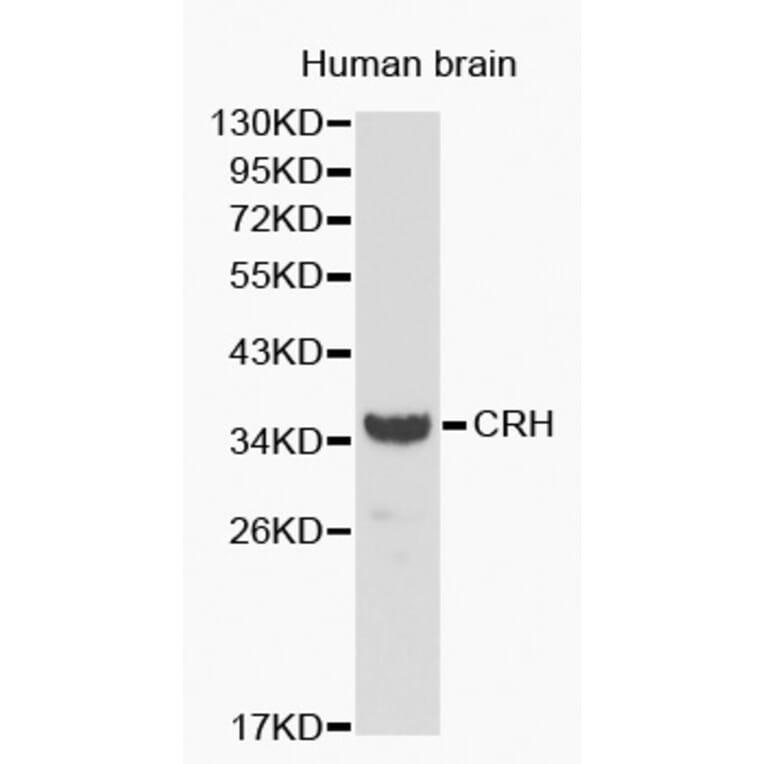 Western blot - CRH antibody from Signalway Antibody (38192) - Antibodies.com